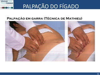 PALPAÇÃO DO FÍGADO
10
Palpação em garra (Técnica de Mathieu)
 