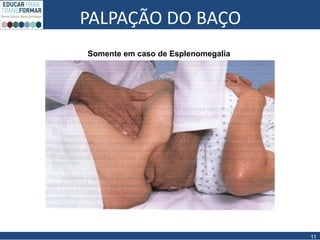 PALPAÇÃO DO BAÇO
11
Somente em caso de Esplenomegalia
 