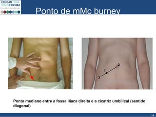Ponto de mMc burney
14
Ponto mediano entre a fossa ilíaca direita e a cicatriz umbilical (sentido
diagonal)
 