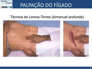 PALPAÇÃO DO FÍGADO
9
Técnica de Lemos-Torres (bimanual profunda)
 