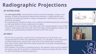 Radiographic Projections
•The AP supine KUB, is performed to demonstrate the kidneys, ureters, and
bladder, as well as the general abdominal anatomies. It helps identify and
visualize the bowel gas patterns, organ enlargement, calcifications, and the
presence of masses.
•It is generally the baseline image in any abdominal related projection, providing
an overview before further projections are taken.
•The patient must lie supine on the table, with their hands placed on top of their
chest or sides away from the trunk, with their legs rotated slightly inwards, the
central ray is positioned just below the level of the iliac crests.
AP SUPINE (KUB)
AP ERECT
•The AP erect projection is performed to demonstrate air-fluid levels and
intraperitoneal air within the abdominal cavity. It is valuable in the assessment
of bowel obstruction, perforation, and other acute abdominal conditions.
•This view is often taken after the supine projection to provide complementary
diagnostic information.
•Here whether the patient is standing/sitting, the patient’s back must be against
the bucky, here the X-ray beam is centered at a point just above the iliac crests
for both standing and sitting projections.
 