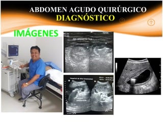 DIAGNÓSTICO
IMÁGENES
INTRODUCCIONABDOMEN AGUDO QUIRÚRGICO
 