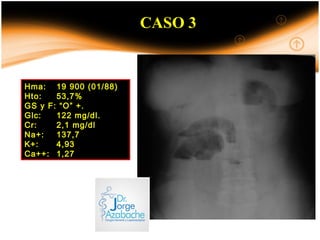 CASO 3
Hma: 19 900 (01/88)
Hto: 53,7%
GS y F: “O” +.
Glc: 122 mg/dl.
Cr: 2,1 mg/dl
Na+: 137,7
K+: 4,93
Ca++: 1,27
 