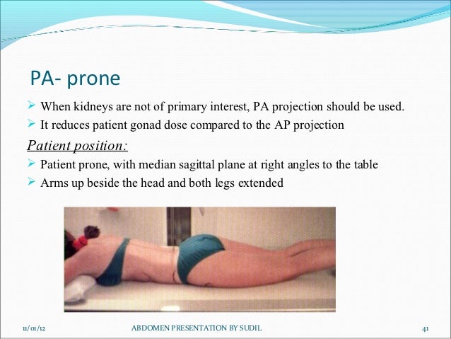 Abdomen radiography