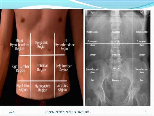 Abdomen radiography