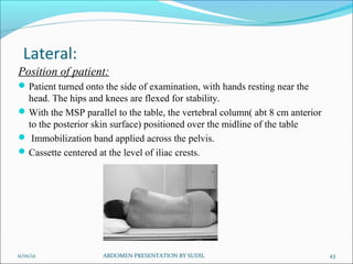 Lateral:
11/01/12 ABDOMEN PRESENTATION BY SUDIL 43
Position of patient:
Patient turned onto the side of examination, with hands resting near the
head. The hips and knees are flexed for stability.
With the MSP parallel to the table, the vertebral column( abt 8 cm anterior
to the posterior skin surface) positioned over the midline of the table
 Immobilization band applied across the pelvis.
Cassette centered at the level of iliac crests.
 