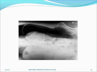 11/01/12 53
ABDOMEN PRESENTATION BY SUDIL
 
