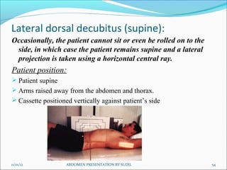 Lateral dorsal decubitus (supine):
Occasionally, the patient cannot sit or even be rolled on to the
side, in which case the patient remains supine and a lateral
projection is taken using a horizontal central ray.
Patient position:
 Patient supine
 Arms raised away from the abdomen and thorax.
 Cassette positioned vertically against patient’s side
11/01/12 54
ABDOMEN PRESENTATION BY SUDIL
 