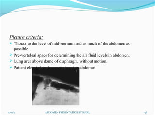 Picture criteria:
 Thorax to the level of mid-sternum and as much of the abdomen as
possible.
 Pre-vertebral space for determining the air fluid levels in abdomen.
 Lung area above dome of diaphragm, without motion.
 Patient elevated to demonstrate entire abdomen
11/01/12 56
ABDOMEN PRESENTATION BY SUDIL
 