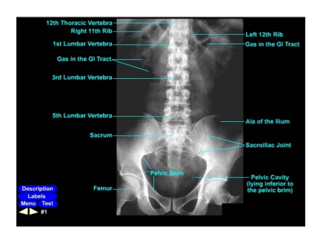 abdominal x ray powerpoint presentation