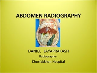 ABDOMEN RADIOGRAPHY
DANIEL JAYAPRAKASH
Radiographer
Khorfakkhan Hospital
 