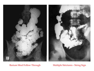 abdomen Radiology -radiologicl anatomyai.pptx
