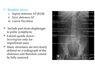 abdomen Radiology -radiologicl anatomyai.pptx