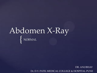 {
Abdomen X-Ray
NORMAL
DR. ANUBHAV
Dr. D.Y. PATIL MEDICAL COLLEGE & HOSPITAL PUNE
 