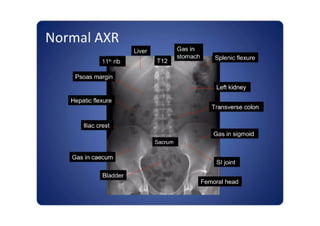 abdomen and kub radiology anatomy xray view.pdf