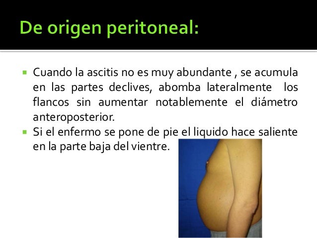 Como adelgazar en el vientre el modo más eficaz