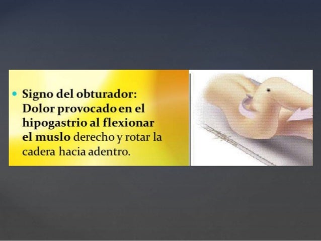 Cuántos días son posibles poner los bancos a la osteocondrosis