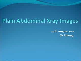 17th, August 2012
Dr Huong
 