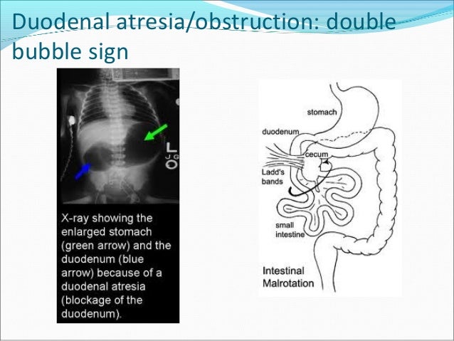 Abdominal xray images