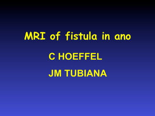 MRI of fistula in ano
C HOEFFEL
JM TUBIANA

 