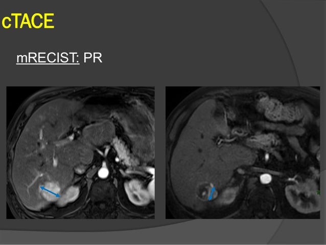 Abdominal Imaging T Responses Y Menu