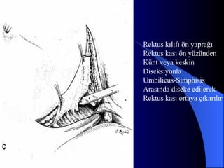 Rektus kılıfı ön yaprağı Rektus kası ön yüzünden  Künt veya keskin  Diseksiyonla Umbilicus-Simphisis  Arasında diseke edilerek Rektus kası ortaya çıkarılır 