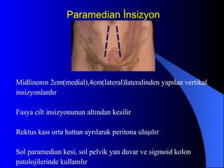 Paramedian İnsizyon Midlinenın 2cm(medial),4cm(lateral)lateralinden yapılan vertikal insizyonlardır Fasya cilt insizyonunun altından kesilir Rektus kası orta hattan ayrılarak peritona ulaşılır Sol paramedian kesi, sol pelvik yan duvar ve sigmoid kolon patolojilerinde kullanılır 
