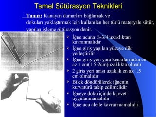 Temel Sütürasyon Teknikleri İğne ucuna ½-3/4 uzaklıktan kavranmalıdır İğne giriş yapılan yüzeye dik yerleştirilir İğne giriş yeri yara kenarlarından en az 1 cm(1.5-2cm)uzaklıkta olmalı 2 giriş yeri arası uzaklık en az 1.5 cm olmalıdır Bilek döndürülerek iğnenin kurvatürü takip edilmelidir İğneye doku içinde kuvvet uygulanmamalıdır İğne ucu aletle kavranmamalıdır Tanım:  Kanayan damarları bağlamak ve  dokuları yaklaştırmak için kullanılan her türlü materyale sütür, yapılan işleme sütürasyon denir. 