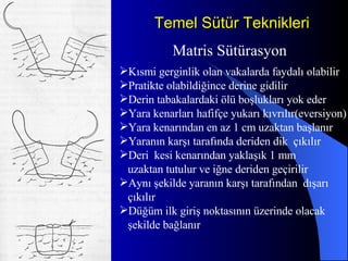 Temel Sütür Teknikleri Matris Sütürasyon Kısmi gerginlik olan vakalarda faydalı olabilir Pratikte olabildiğince derine gidilir Derin tabakalardaki ölü boşlukları yok eder Yara kenarları hafifçe yukarı kıvrılır(eversiyon) Yara kenarından en az 1 cm uzaktan başlanır  Yaranın karşı tarafında deriden dik  çıkılır Deri  kesi kenarından yaklaşık 1 mm uzaktan tutulur ve iğne deriden geçirilir Aynı şekilde yaranın karşı tarafından  dışarı çıkılır  Düğüm ilk giriş noktasının üzerinde olacak şekilde bağlanır 