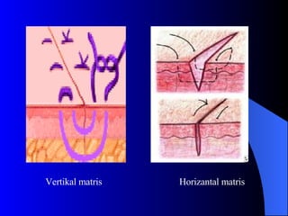 Vertikal matris Horizantal matris 