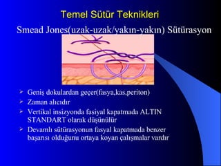 Temel Sütür Teknikleri Geniş dokulardan geçer(fasya,kas,periton) Zaman alıcıdır Vertikal insizyonda fasiyal kapatmada ALTIN STANDART olarak düşünülür Devamlı sütürasyonun fasyal kapatmada benzer başarısı olduğunu ortaya koyan çalışmalar vardır Smead Jones(uzak-uzak/yakın-yakın) Sütürasyon 