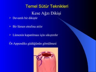Temel Sütür Teknikleri Kese Ağzı Dikişi Devamlı bir dikiştir Bir lümen etrafına atılır Lümenin kapatılması için sıkıştırılır Ör:Appendiks güdüğünün gömülmesi 