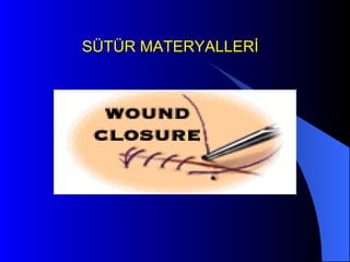 SÜTÜR MATERYALLERİ 