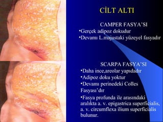CAMPER FASYA’SI Gerçek adipoz dokudur Devamı L.majustaki yüzeyel fasyadır SCARPA FASYA’SI Daha ince,areolar yapıdadır Adipoz doku yoktur Devamı perinedeki Colles Fasyası’dır Fasya profunda ile arasındaki aralıkta a. v. epigastrica superficialis, a. v. circumflexa ilium superficialis bulunur. CİLT ALTI 