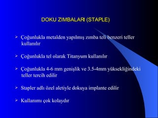 DOKU ZIMBALARI (STAPLE) Çoğunlukla metalden yapılmış zımba teli benzeri teller kullanılır Çoğunlukla tel olarak Titanyum kullanılır Çoğunlukla 4-6 mm genişlik ve 3.5-4mm yüksekliğindeki teller tercih edilir Stapler adlı özel aletiyle dokuya implante edilir Kullanımı çok kolaydır 