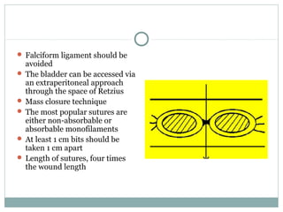  Falciform ligament should be
  avoided
 The bladder can be accessed via
  an extraperitoneal approach
  through the space of Retzius
 Mass closure technique
 The most popular sutures are
  either non-absorbable or
  absorbable monofilaments
 At least 1 cm bits should be
  taken 1 cm apart
 Length of sutures, four times
  the wound length
 
