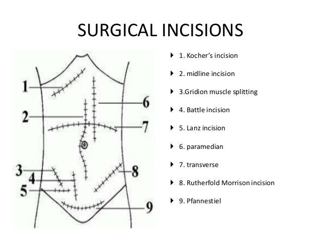 Abdominal Access Presentation