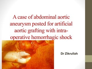 Acase of abdominal aortic
aneurysm posted for artificial
aortic grafting with intra-
operative hemorrhagic shock
Dr Zikrullah
 