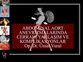 ABDOMİNAL AORT 
ANEVRİZMALARINDA 
CERRAHİ YAKLAŞIM VE 
KOMPLİKASYONLAR 
Op. Dr. Ünsal Vural 
 