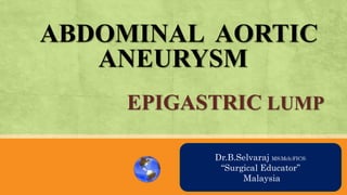 ABDOMINAL AORTIC
ANEURYSM
EPIGASTRIC LUMP
AN OVRVIEW
Dr.B.Selvaraj MS;Mch;FICS;
“Surgical Educator”
Malaysia
 