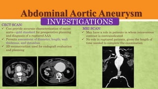 ABDOMINAL AORTIC ANEURYSM- EPIGASTRIC LUMPS- Abdominal Lumps.pptx
