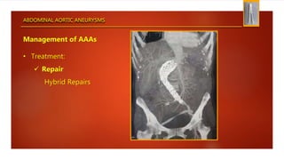 ABDOMINAL AORTIC ANEURYSMS
Management of AAAs
• Treatment:
 Repair
Hybrid Repairs
 