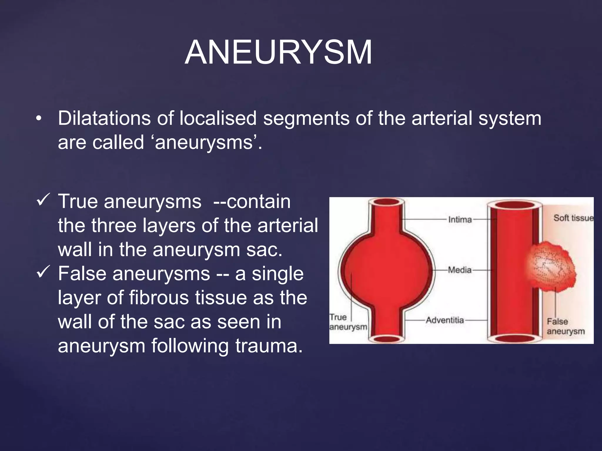 Abdominal aortic aneurysm | PPTX