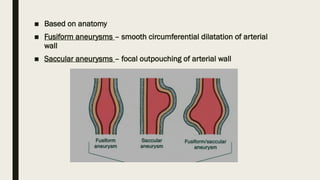 abdominal aortic aneurysms.pptx GENERALSURGERY | PPTX