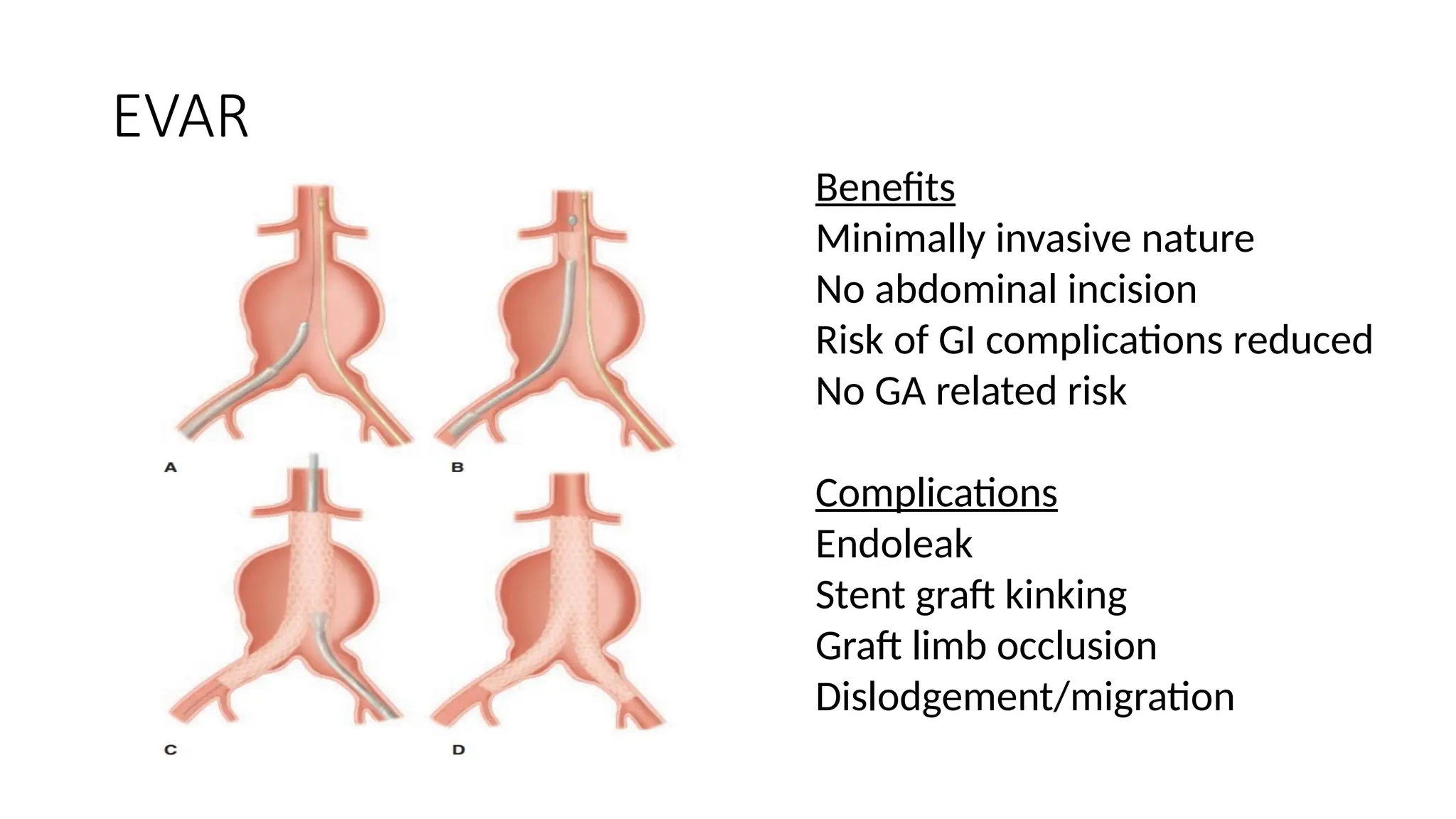 Abdominal Aortic aneurysm intro till management .pptx