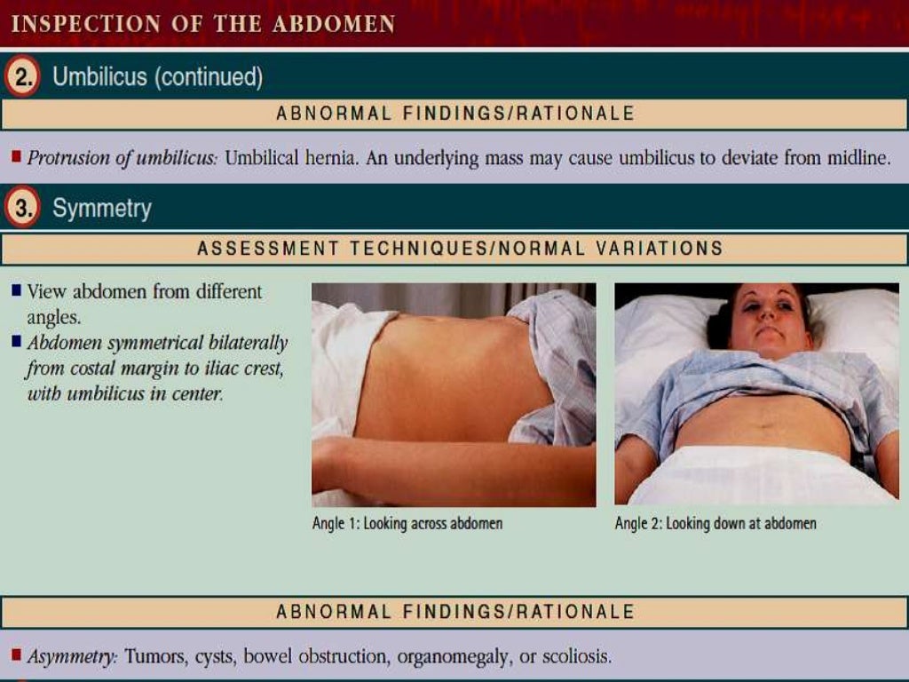 Abdominal assessment