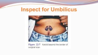 Inspect for Umbilicus
 