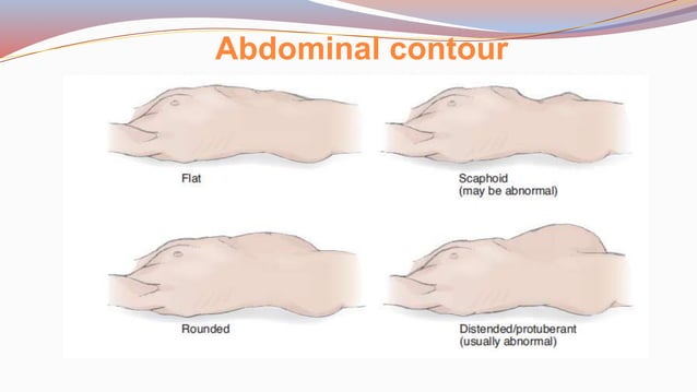 Abdominal Assessment.pptx