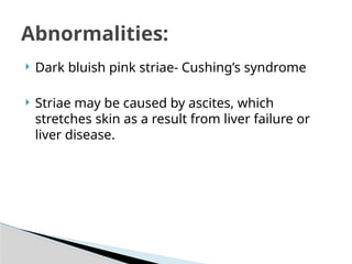  Dark bluish pink striae- Cushing’s syndrome
 Striae may be caused by ascites, which
stretches skin as a result from liver failure or
liver disease.
Abnormalities:
 