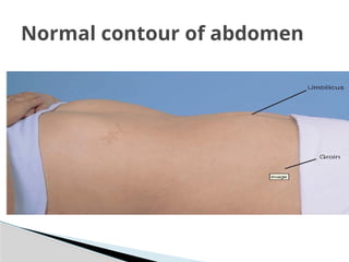 Normal contour of abdomen
 